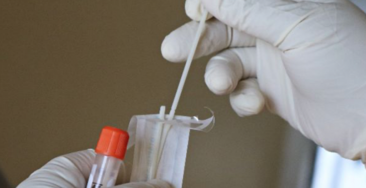 Testing swab